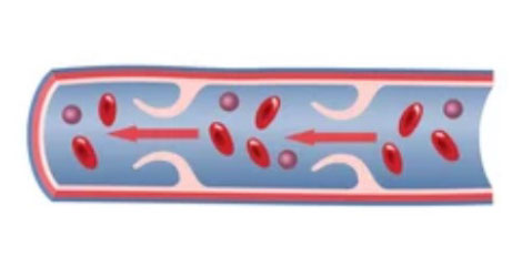 正常な下肢静脈の模式図