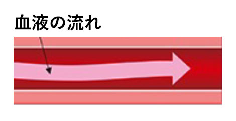 正常な下肢動脈の模式図